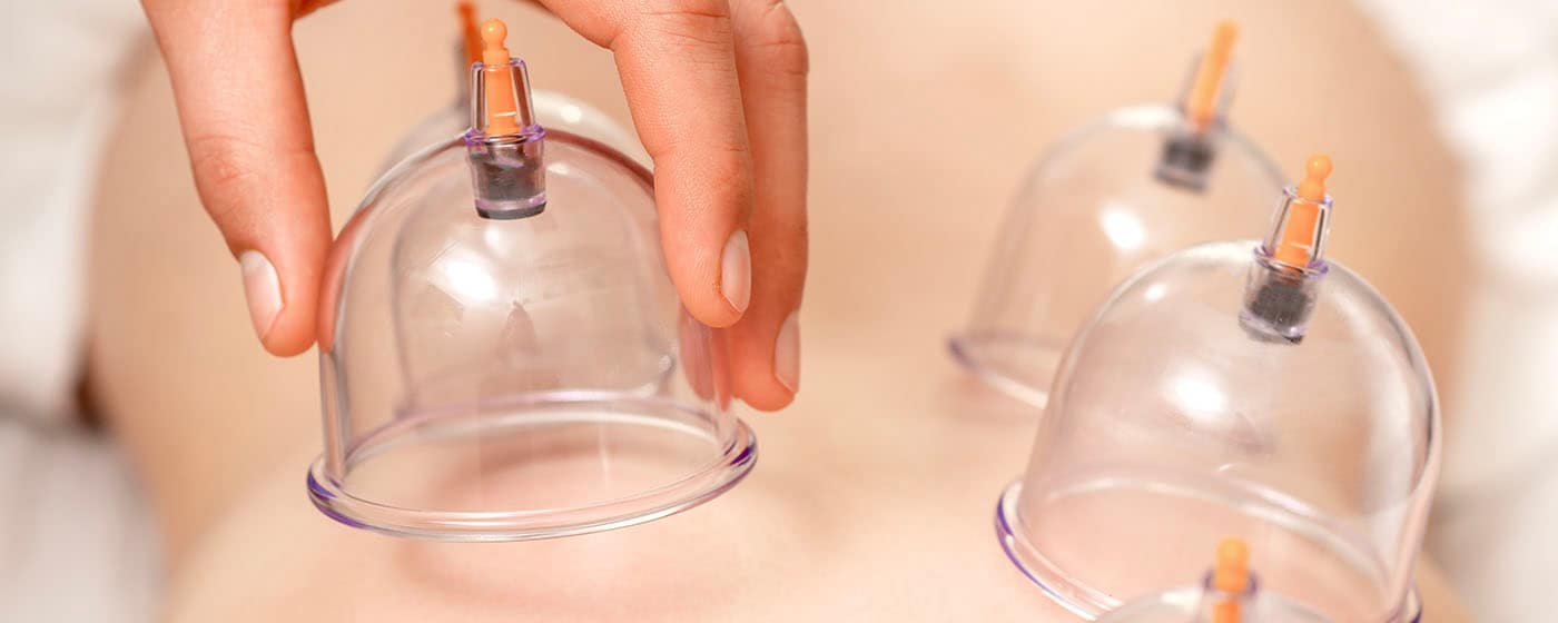 Person receiving Therapeutic Cupping